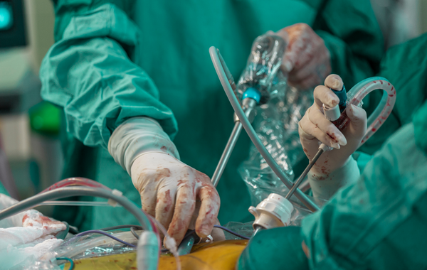 Cirugía laparoscópica Avanzada